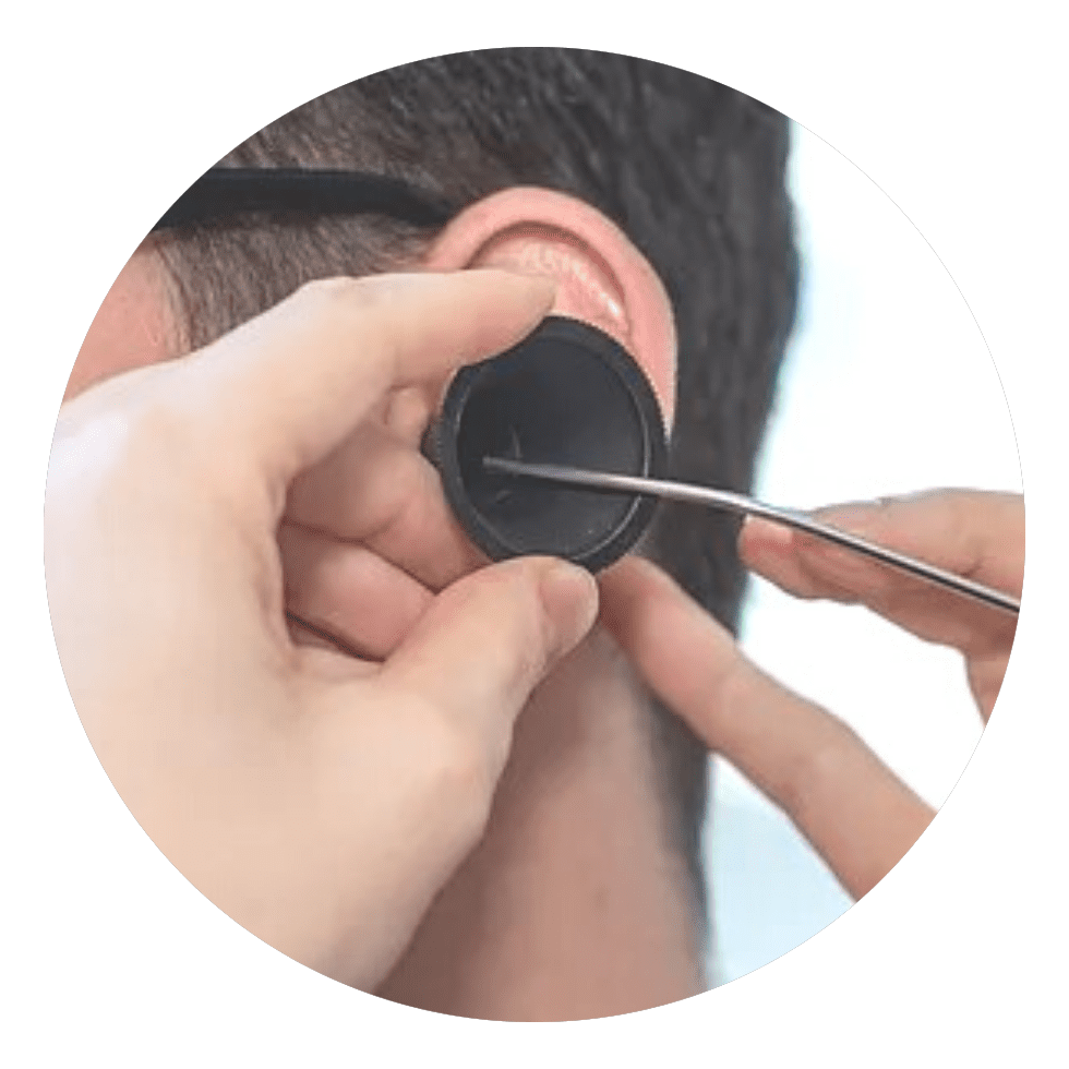 ear_suction_falkirk